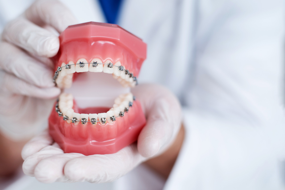 The Role of Facial Aesthetics in Choosing the Right Orthodontic Plan