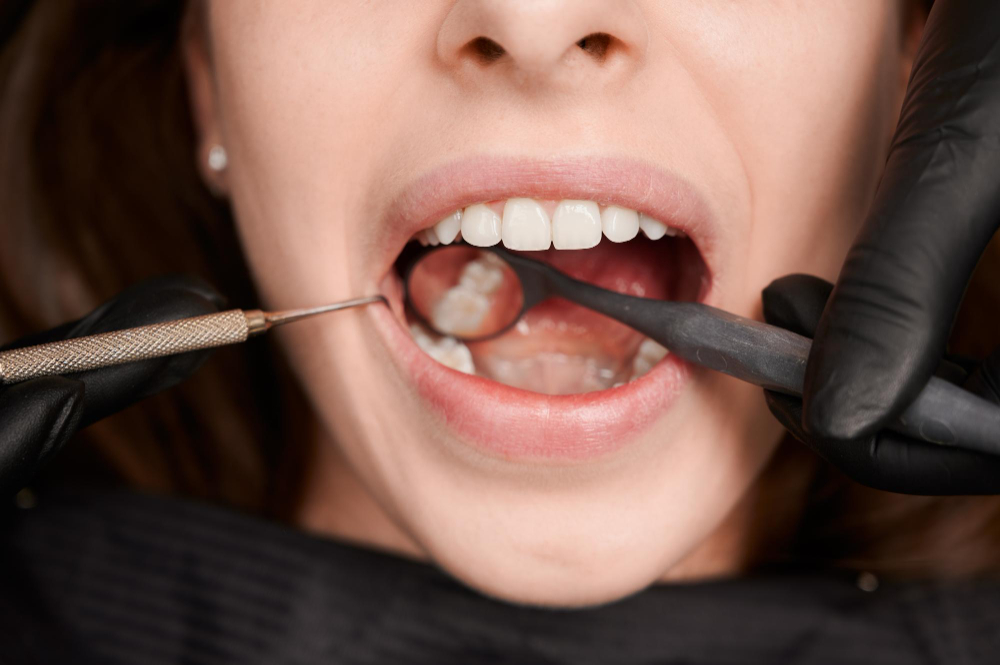root canal treatment in indiranagar