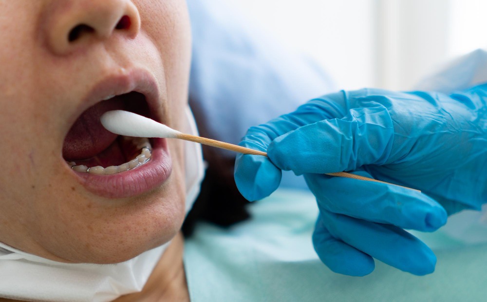 Early Warning Signs of Gum Bleeding and How to Manage Them