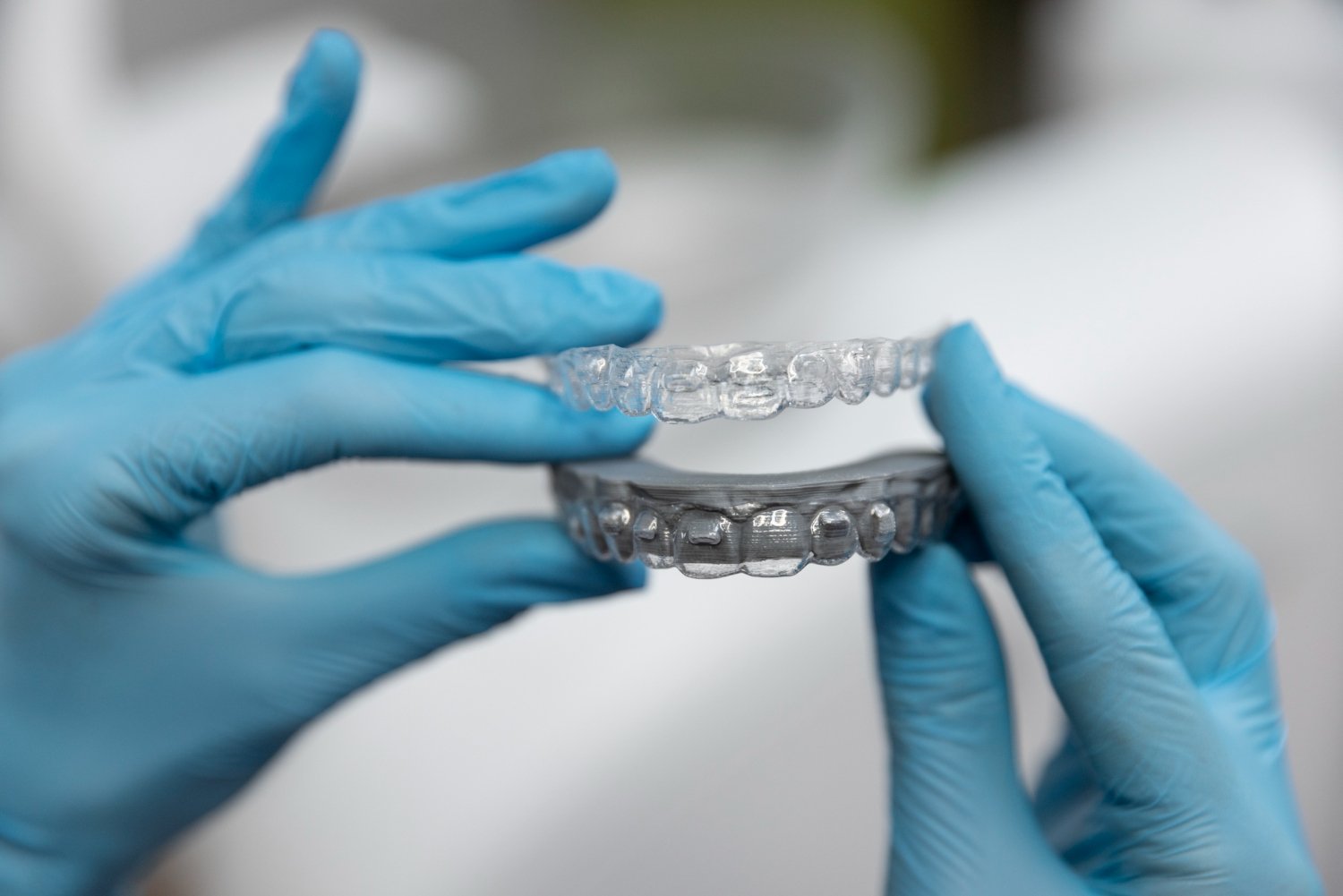 Can Clear Aligners Correct an Underbite? When Orthodontic Treatment May Help